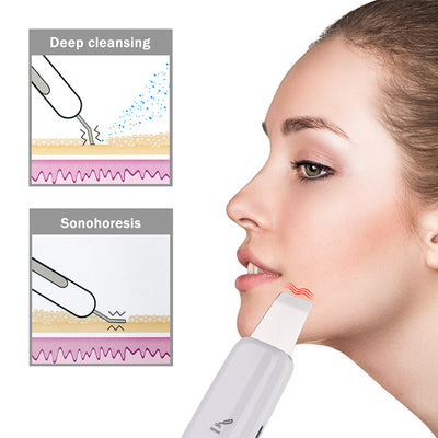 Deep Cleans Dead Skin Cleansing Machine to Remove Blackheads - bankshayes40