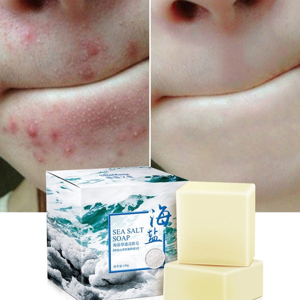Sea Salt Soap Natural Advanced Wash Skin Whitening Soap - bankshayes40